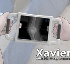 Маленький рентгеновский аппарат