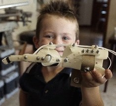 3D-принтер напечатал руку для семилетнего украинского мальчика