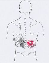 Карта точек боли в теле и точек напряжения мышц (триггеры)