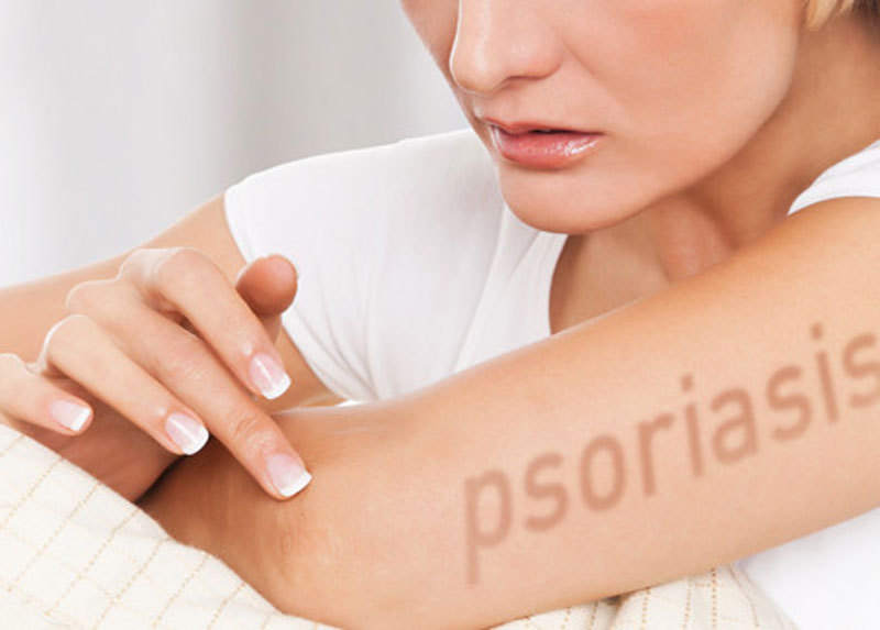 Эффективное лечение голодом псориаза и других заболеваний кожи