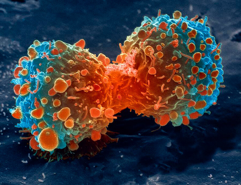 Почему одни раковые клетки умирают, а другие выздоравливают
