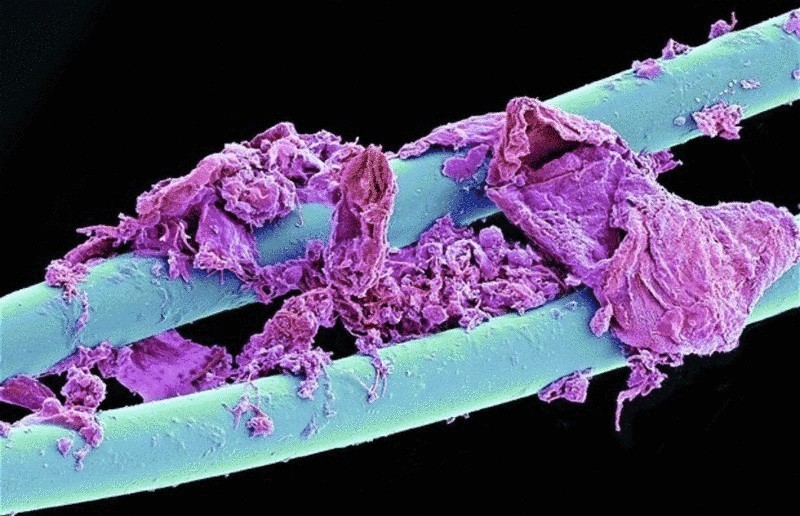 Удивительные микроскопические фотографии