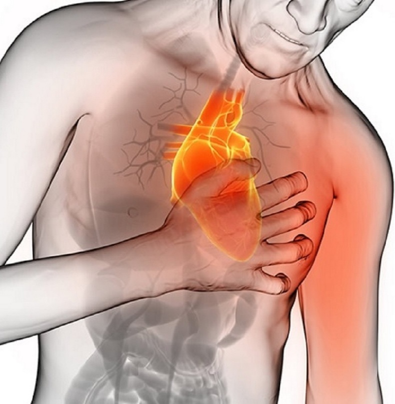 Инфаркт миокарда: Что делать при приступе 