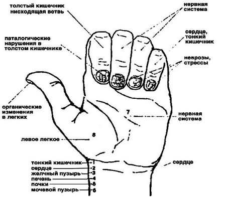 Диагностика по ногтям в восточной медицине