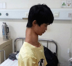 15-летний китайский подросток с самой длинной шеей в мире