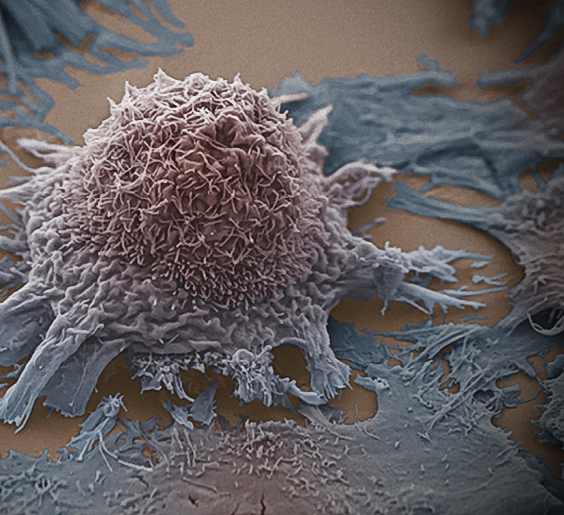 Народное средство лечения онкологии раками thumbnail
