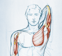 Ограниченная подвижность плечевых суставов