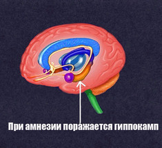 10 фактов об антероградной амнезии