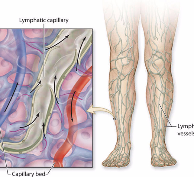 Механизмы нарушения лимфообращения схема