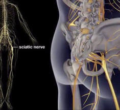 Как разблокировать седалищный нерв: 2 простых способа снять боль