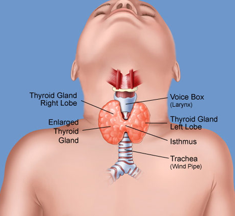 Щитовидная железа у младенцев. Заболевания щитовидной железы у детей. Щитовидная железа у детей симптомы. Щитовидная железа у детей 10 лет