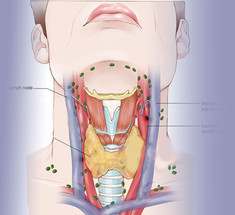Узлы в щитовидной железе: 3 тактики 