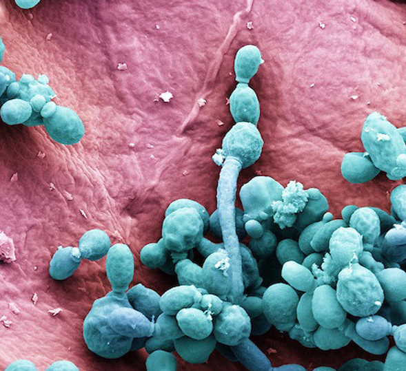 Кандида В Кишечнике Симптомы – Telegraph