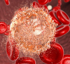 Лейкемия: Симптомы рака крови, которые часто игнорируют