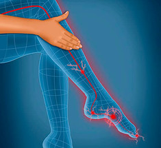 Как проверить здоровье ног: советы ортопедов