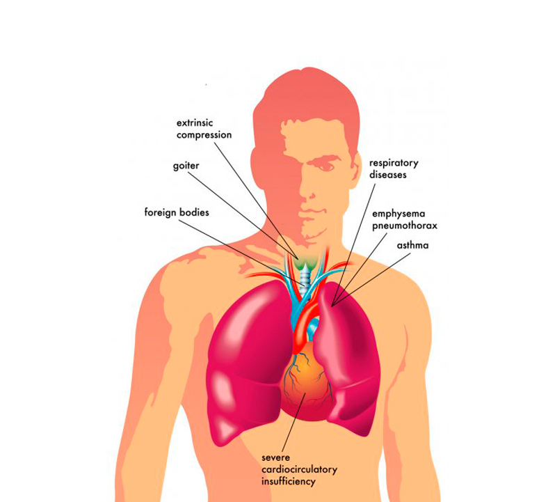 Что такое отдышка у человека. Почему тяжело дышать. Проблемы с дыханием. Почему когда плотно поешь становится трудно дышать. Тяжело дышать.