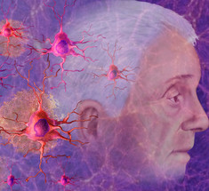 Витамин D и куркумин против болезни Альцгеймера