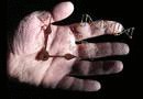 Депрессия и стресс способствуют старению