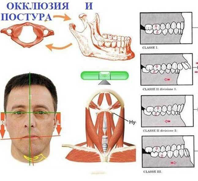 Где болит голова схема