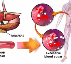 Что важно знать, если уровень сахара в крови выше нормы