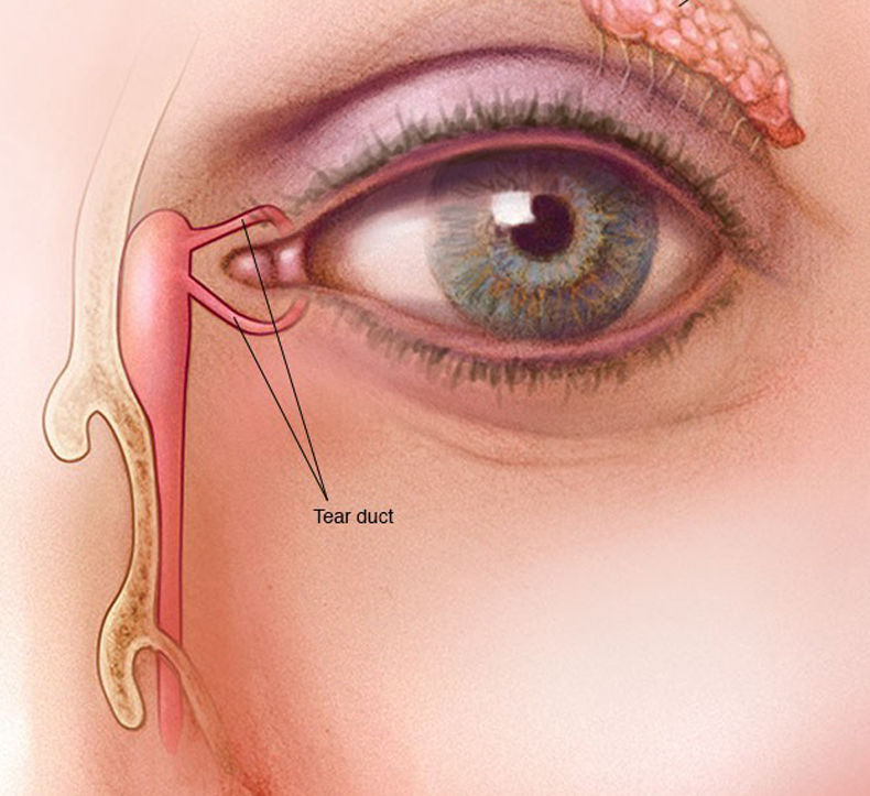 Причины и лечение головокружения и раздвоения в глазах