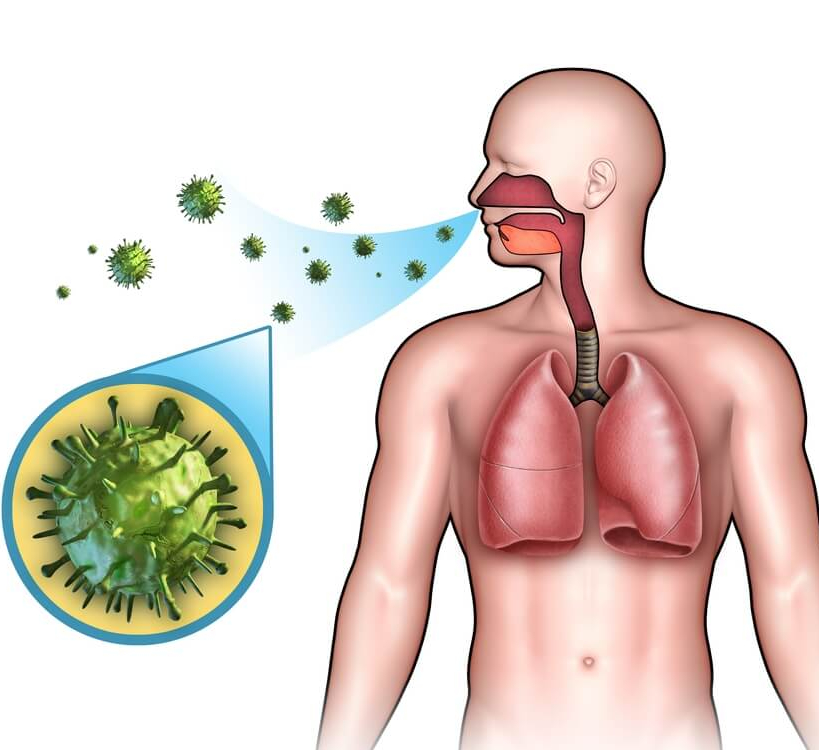 Вирус пневмонии картинки