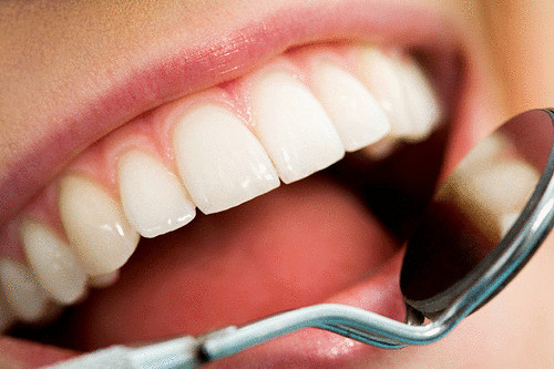 Отбеливание зубов активированным углем 