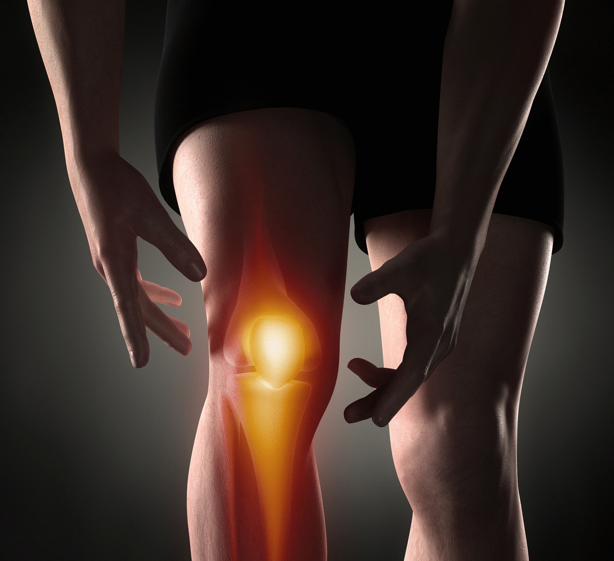 артрит коленного сустава фото лечение