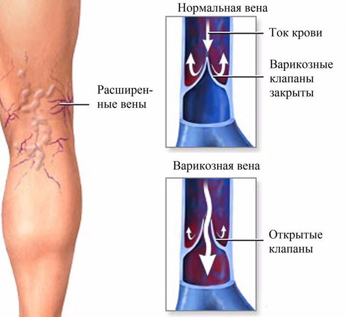 еда для снижения веса рецепты еда для снижения веса рецепты