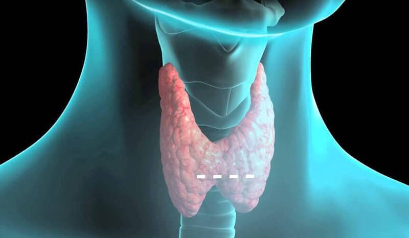 Здоровая щитовидная железа картинка