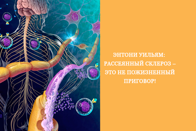 Победила склероз. Рассеянный склероз. Клиническая картина рассеянного склероза. Картинки рассеянного склероза.