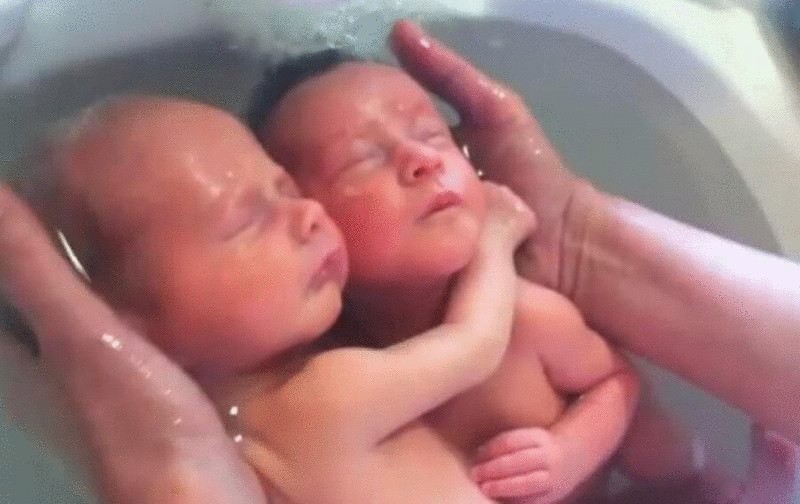 Эти новорожденные близнецы обнимаются! Удивительное и трогательное видео
