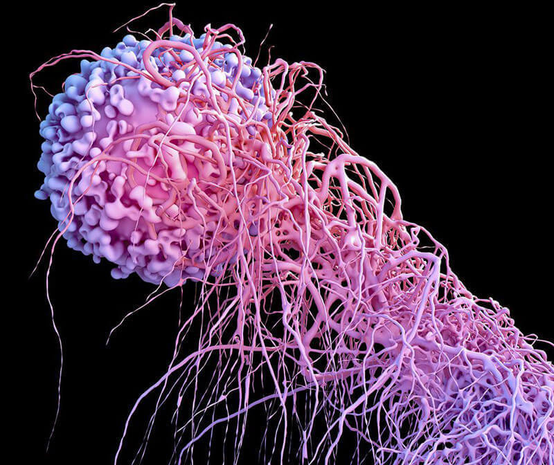 12 мифов официальной онкологии