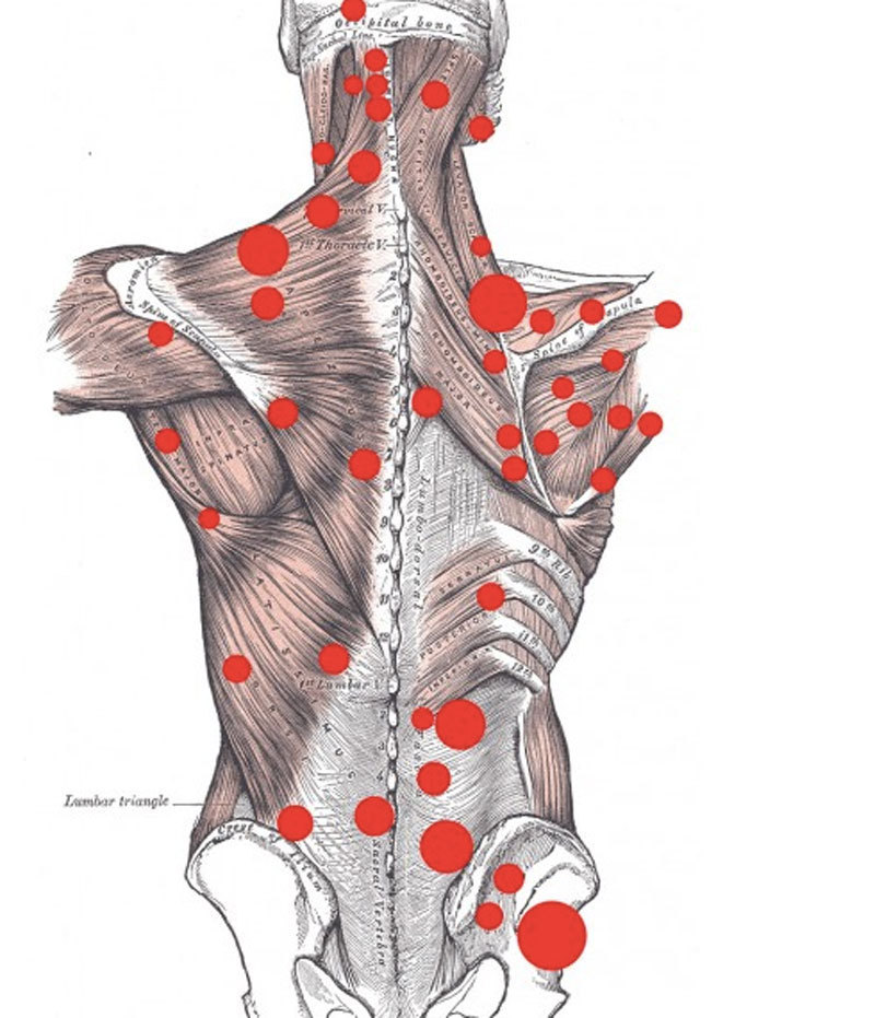 Боль в спине - советы остеопата