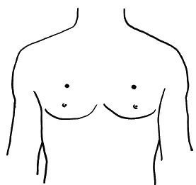 Акупунктурные точки на теле человека при кашле thumbnail