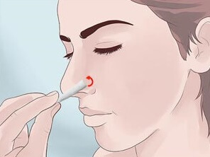 Как БЫСТРО вылечить воспаление носовых пазух БЕЗ лекарств
