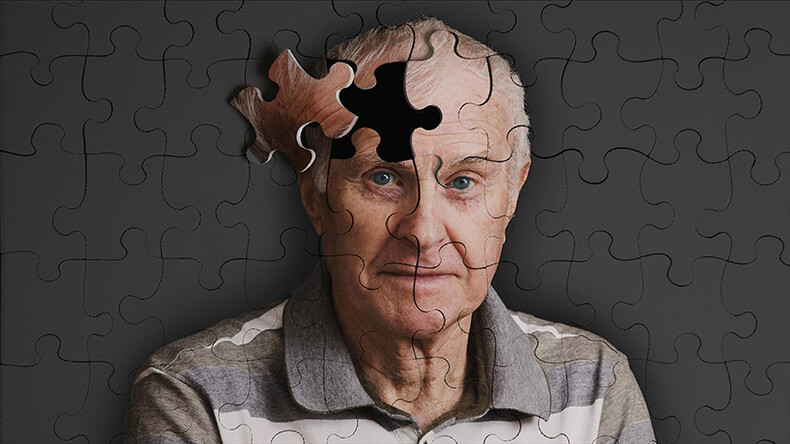 Болезнь Альцгеймера: как замедлить развитие заболевания 