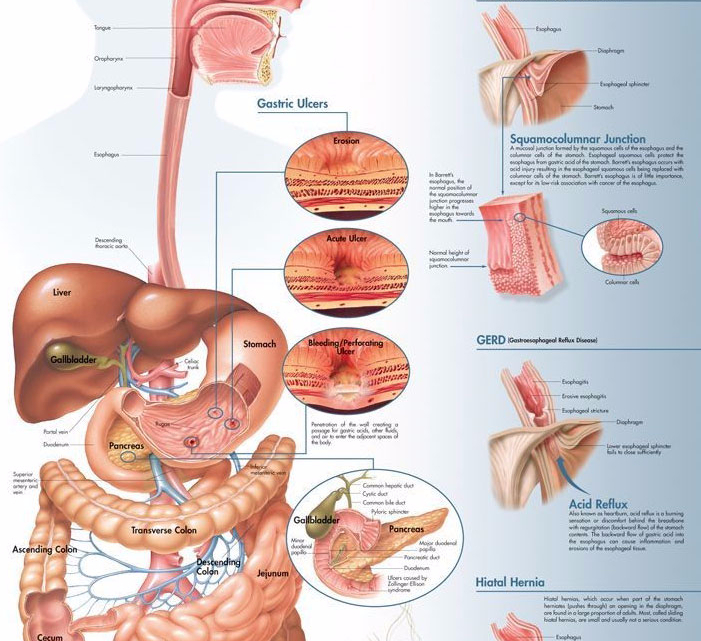 Дырявый кишечник: симптомы, причины и лечение