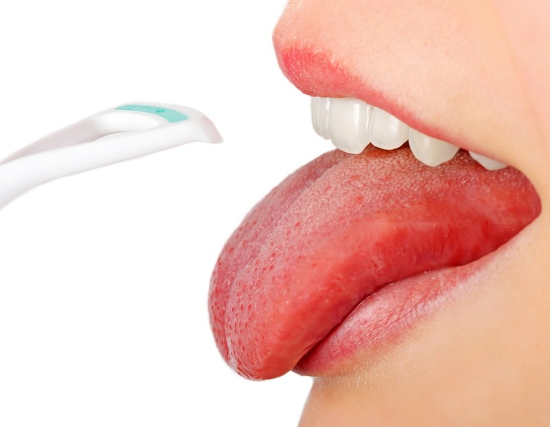 Галитоз: причины неприятного запаха изо рта 