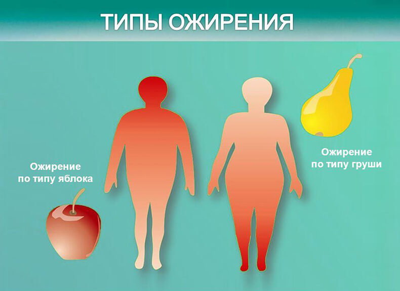 Какие бывают ожирения. Абдоминальный и гиноидный Тип ожирения. Типы ожирения гиноидное и андроидное. Типы ожирения гиноидное. Периферический Тип ожирения.
