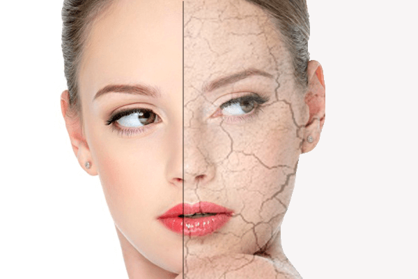 Как очищать лицо с сухой кожей лица thumbnail