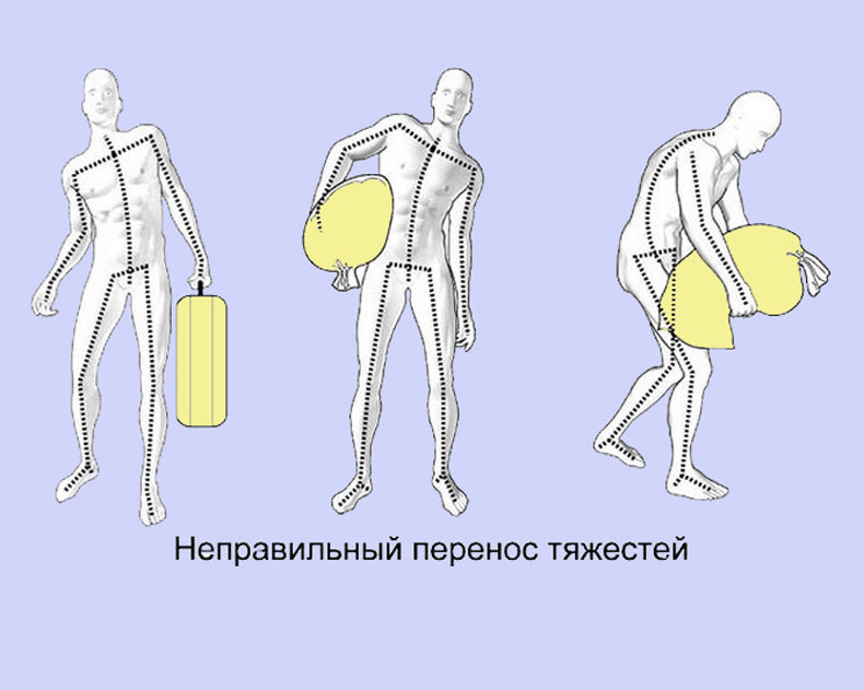 Как правильно сидеть при грыже поясничного отдела позвоночника за компьютером