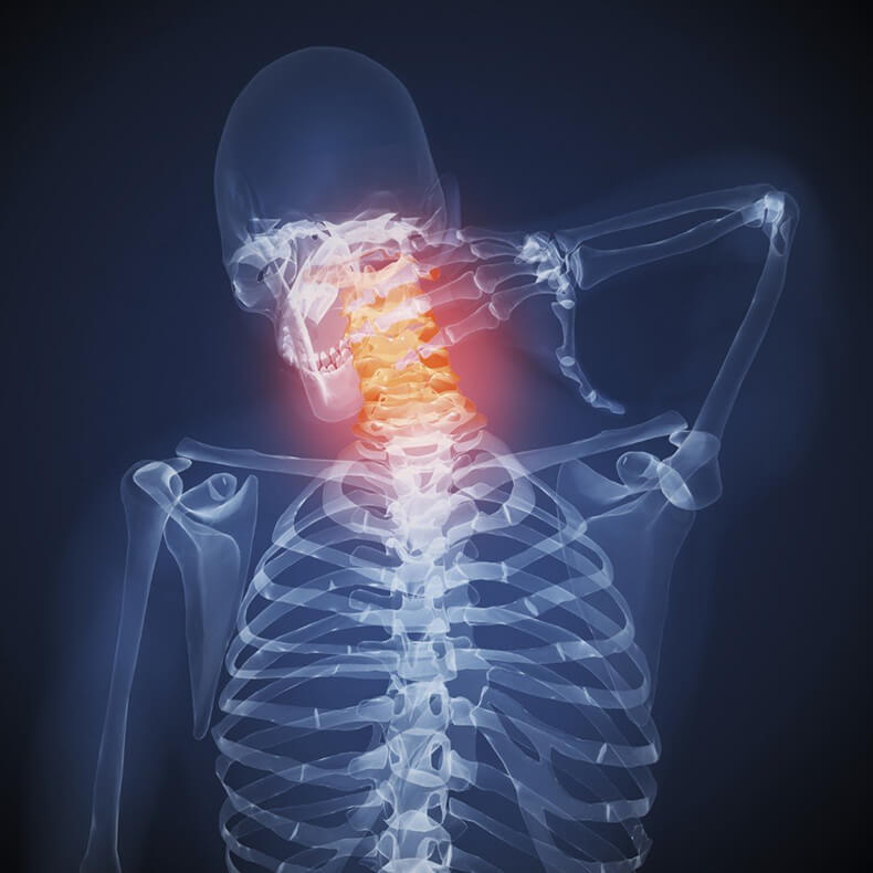 9 упражнений для укрепления мышечного корсета позвоночника при шейном остеохондрозе