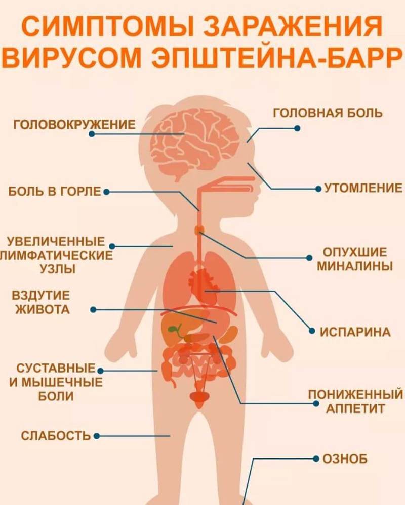 синдром бара