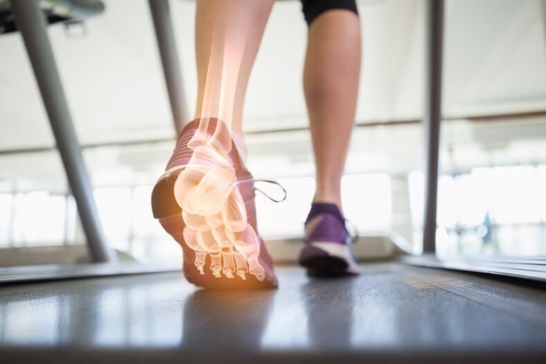 Боль в стопе: Когда надо обратить особое внимание на свои ноги?