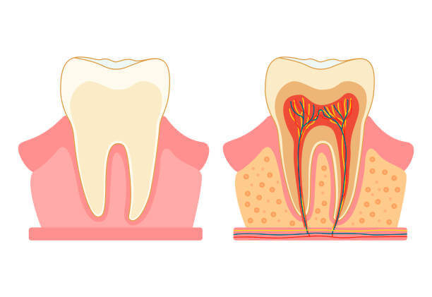 Плохо запломбированный канал зуба симптомы