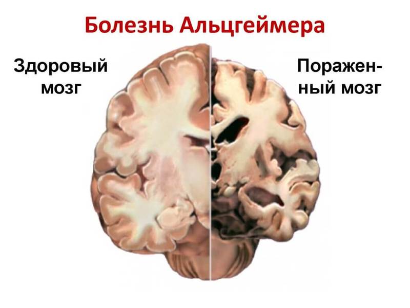 Как по глазам определить болезнь картинки