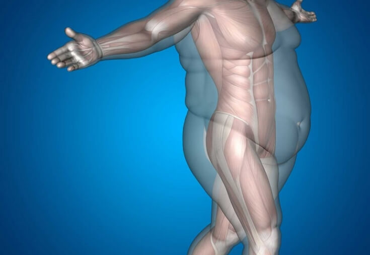 Жир = ожирение – МИФ, уходящий в прошлое
