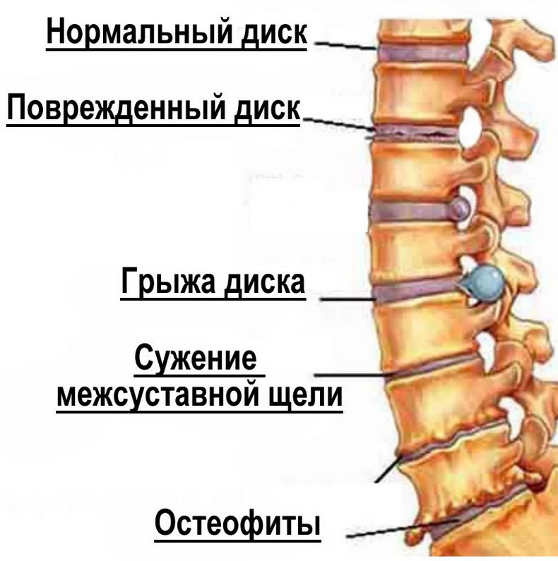 Печет спина что делать