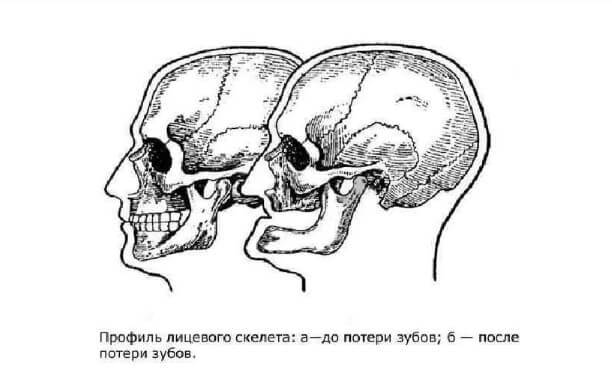 Тейпы от кисетных морщин схема